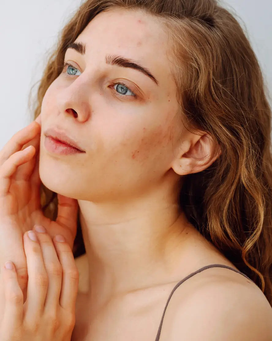Sensitive skin